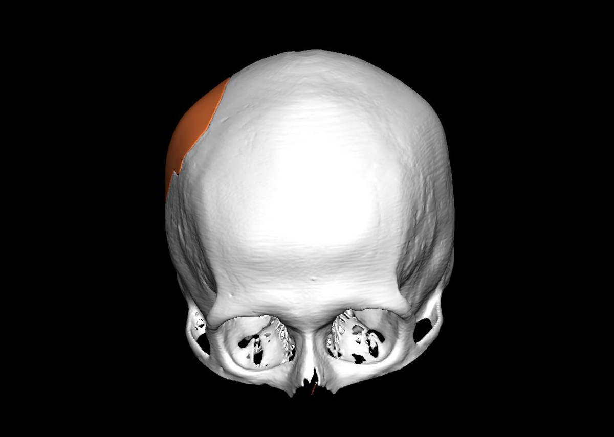 Spinal Applications Overview Image