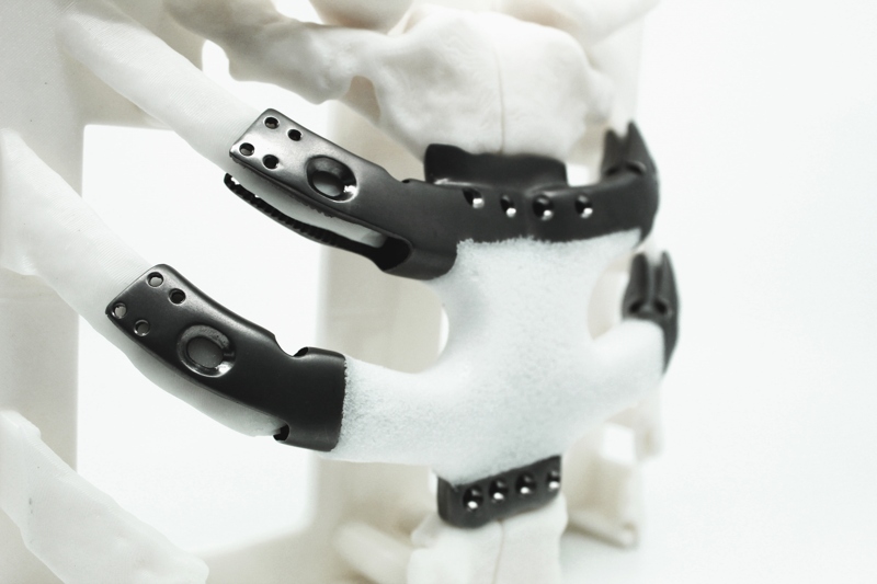 First 3d printer sternum