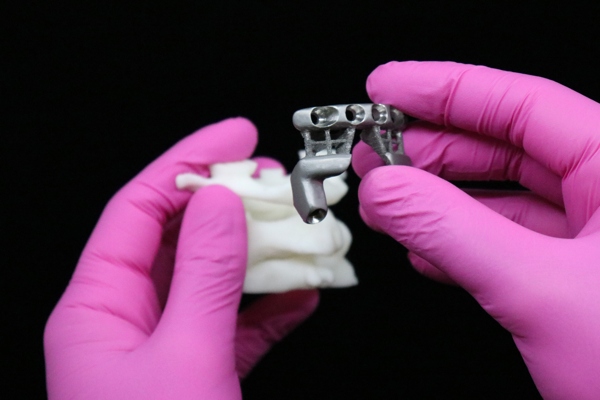 Small SpineCage in hands