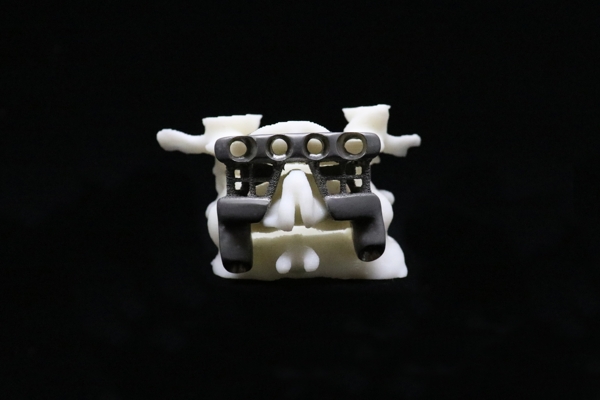 SpineCage Rotation 1